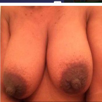 Ellis - Bazentin - Somme | Massage Nue