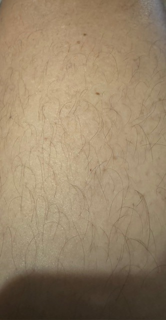 Basil - LePlessis-Patte-d'Oie - Oise | Massage Nue