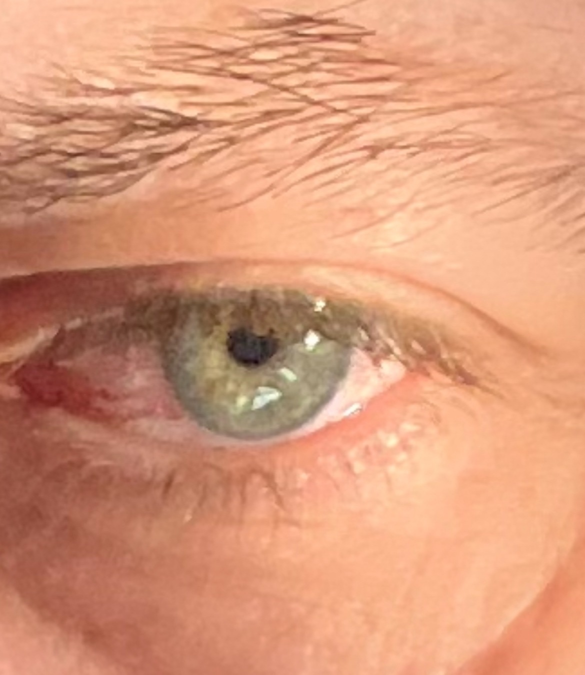 Alassan - Champdray - Vosges | Massage Nue