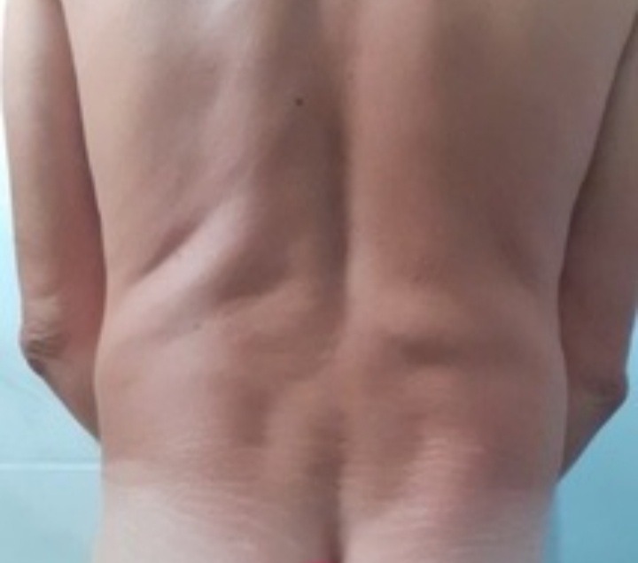 Moulay - Bois-de-Céné - Vendée | Massage Nue